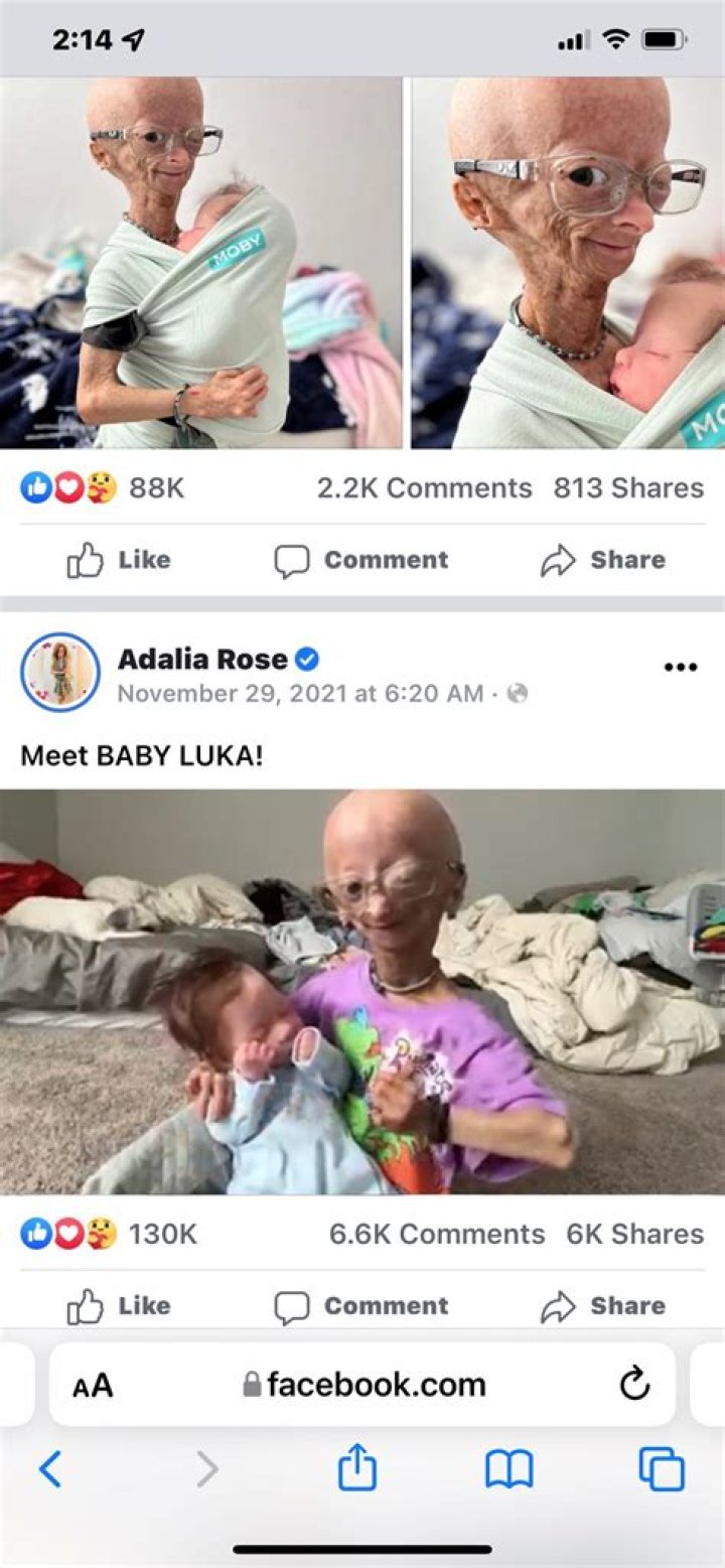 Adalia Rose (facebookstar) Wiki,Age,Birthday,Biography,Height,Net Worth ..